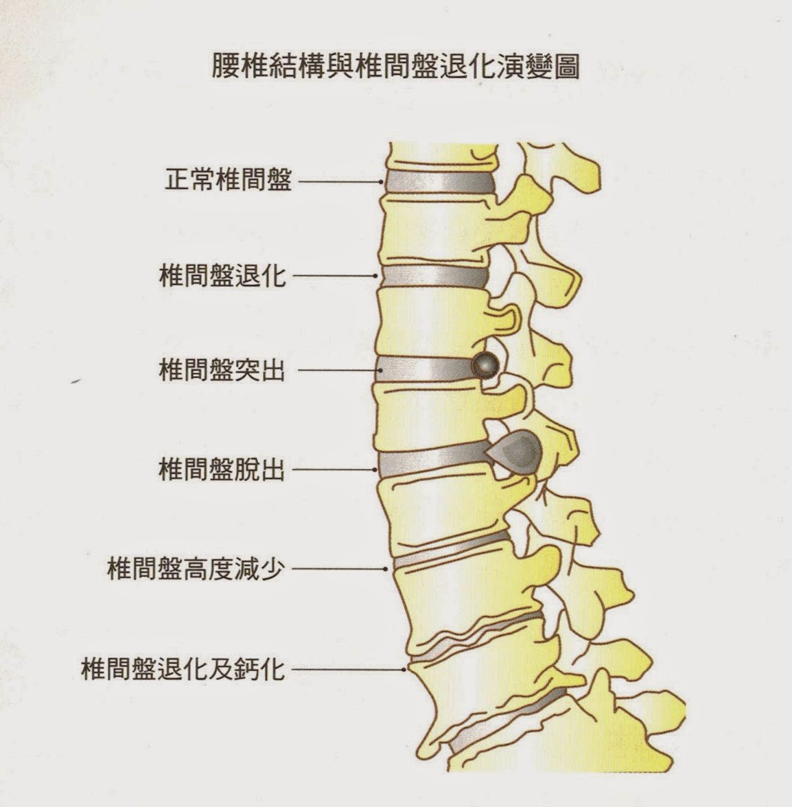 Lumbar structure and disc degeneration Lumbar structure and disc degeneration