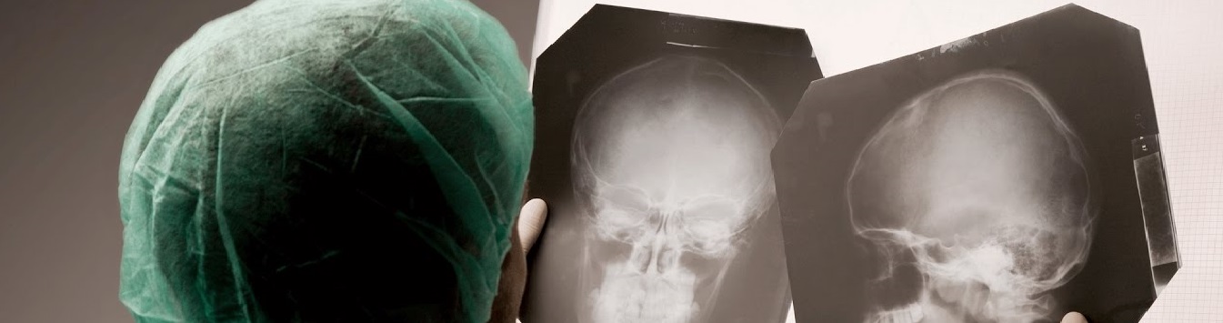 Head injury Head injury