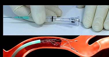 Pro-active Treatment